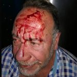 Un vecino de Bailén agrede al concejal de Obras y Servicios, que recibió siete puntos de sutura